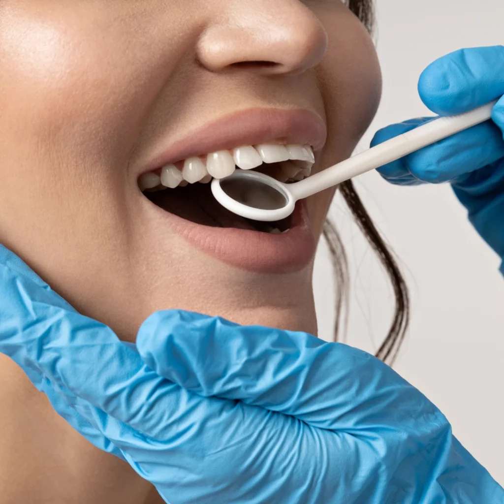 Sbiancamento dentale a Bologna